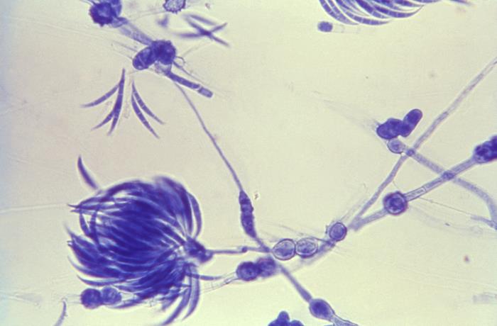 fusarium oxyspora fungus